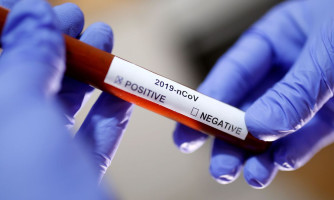 Alto Araguaia registra os dois primeiros casos confirmados de coronavírus