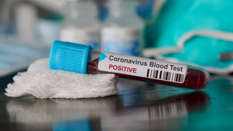 Alto Araguaia registra mais cinco casos de coronavírus